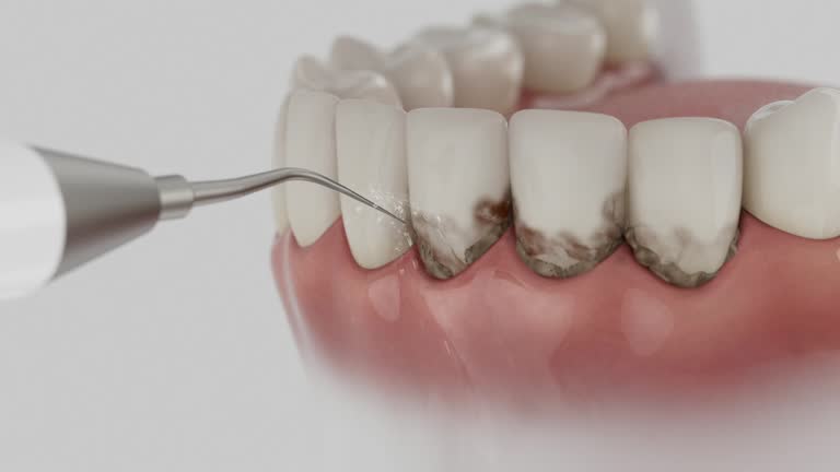 Trusted Dental Implants service in Leawood, KS - Dentist Open Now